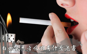 海口儿童白癜风医院 白癜风患者吸烟会有什么影响